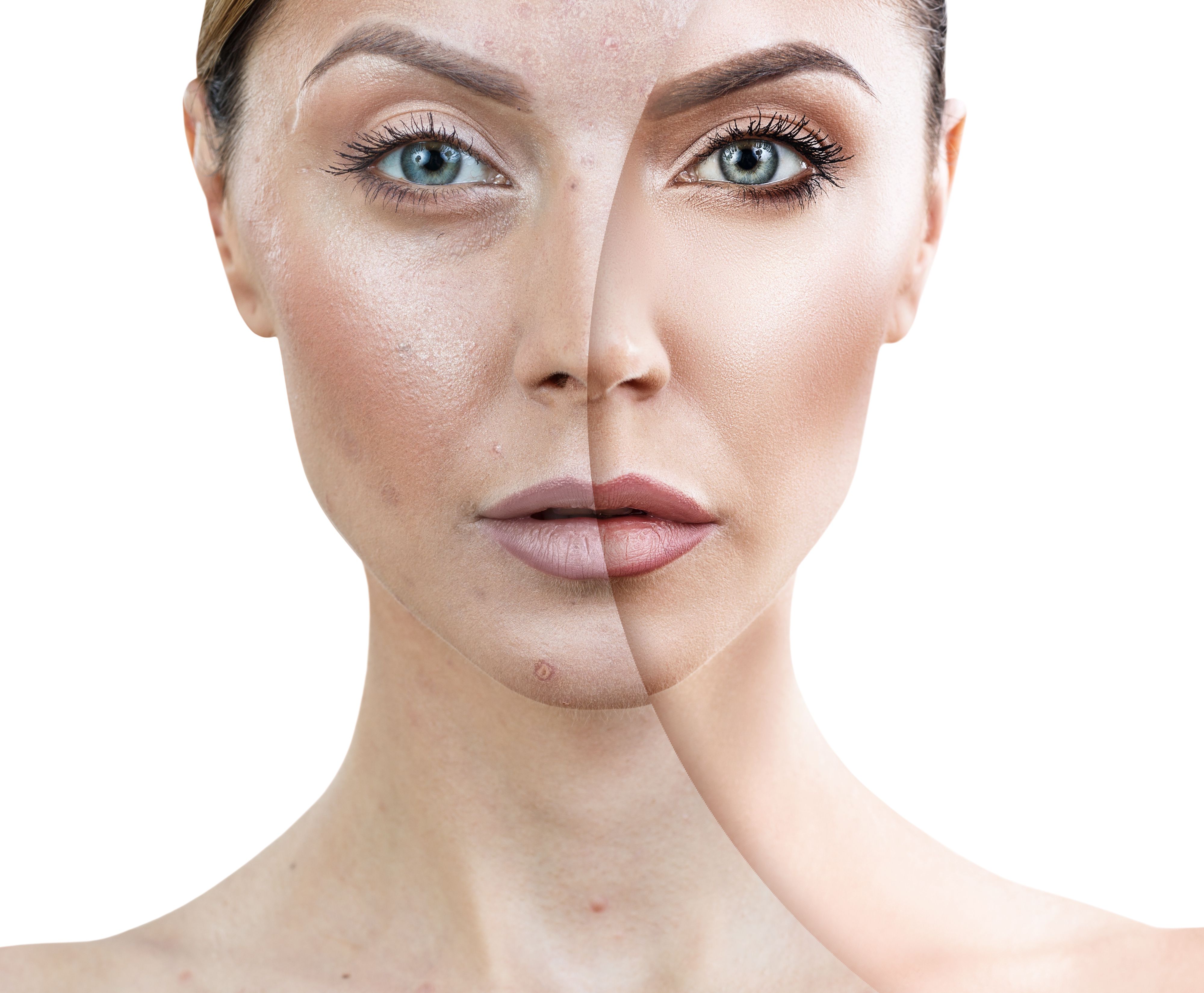 advanced facial procedure