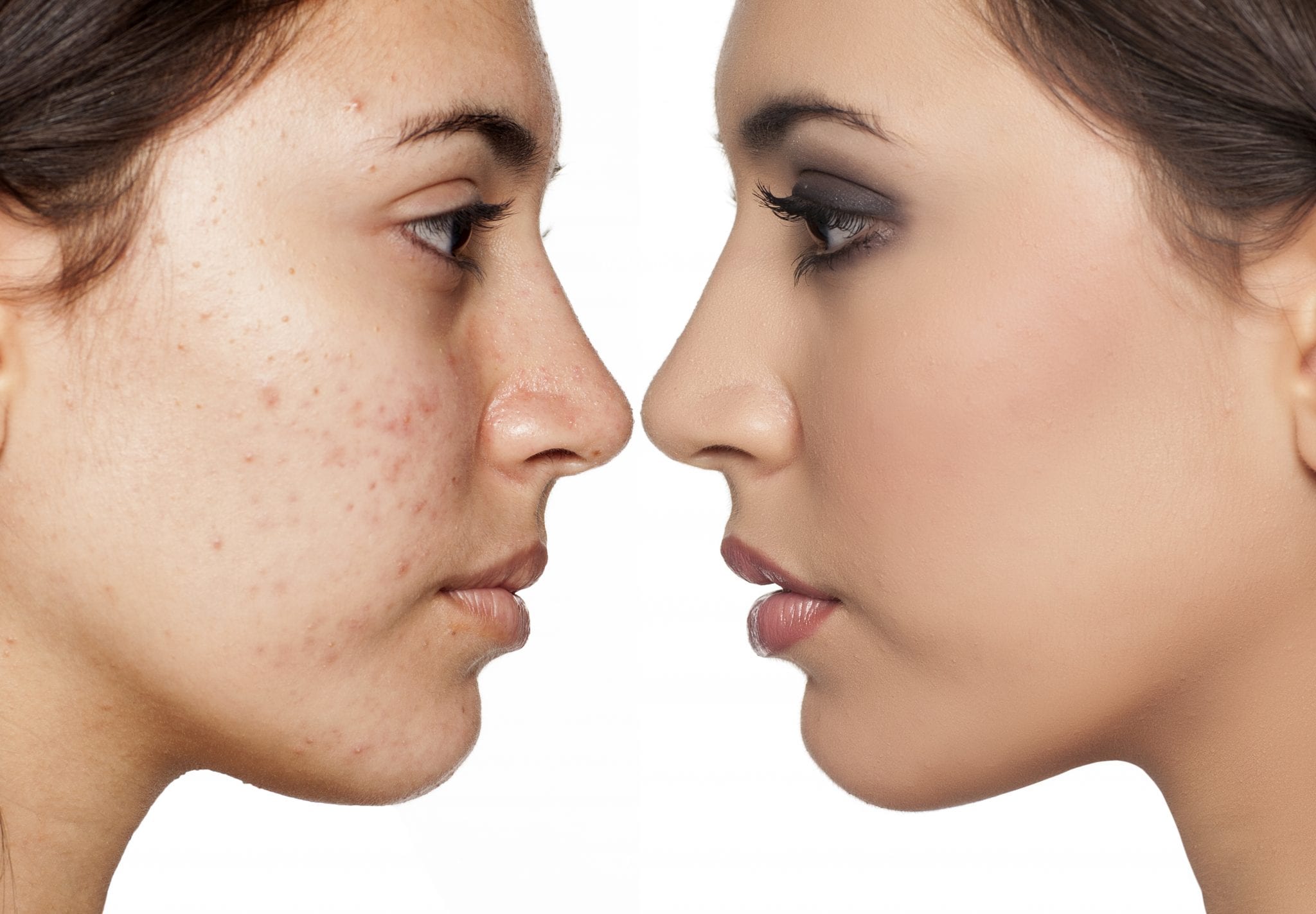 advanced facial procedure