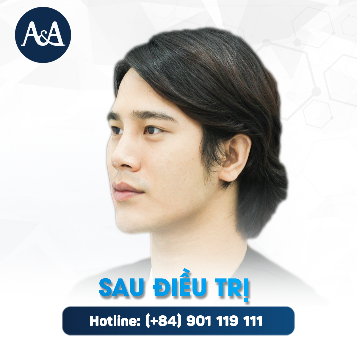 advanced facial procedure