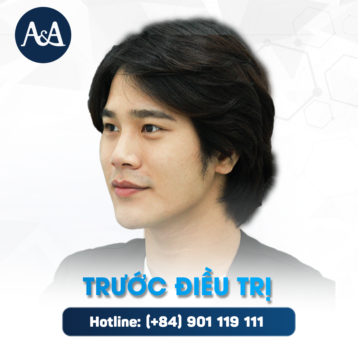 advanced facial procedure