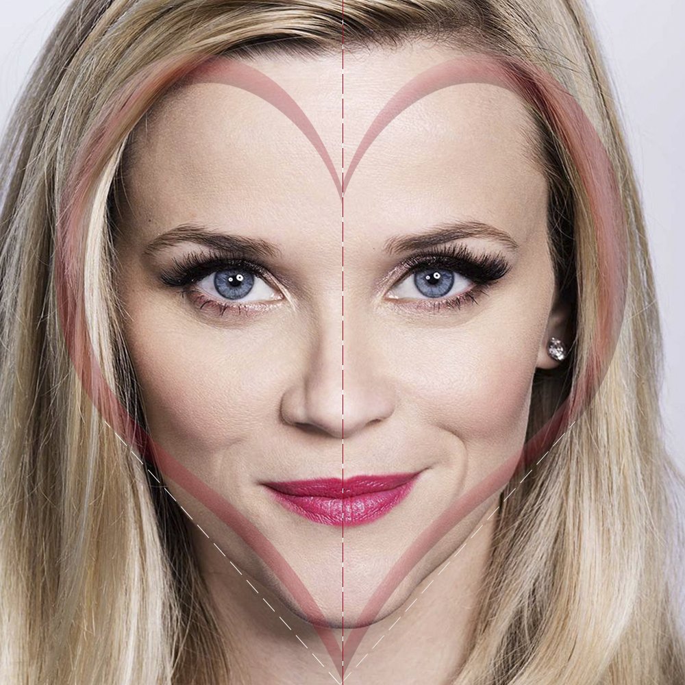 Ulthera-Lift + Botox